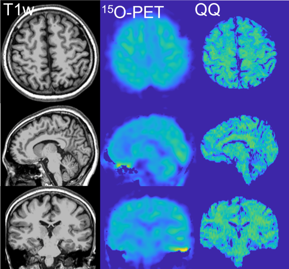 Validation comparison showing T1w, 15O-PET, and QQ brain imaging results across different orientations